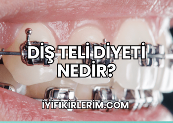 Diş Teli Diyeti Nedir?