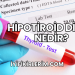 Hipotiroid Diyeti Nedir?